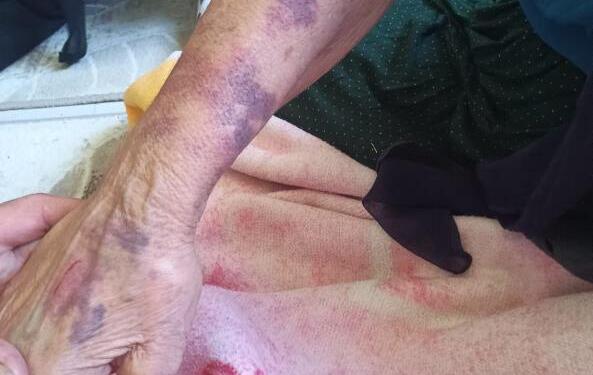 Şirnex’te 75 yaşındaki kadını darp eden kişinin bekçi olduğu ortaya çekti