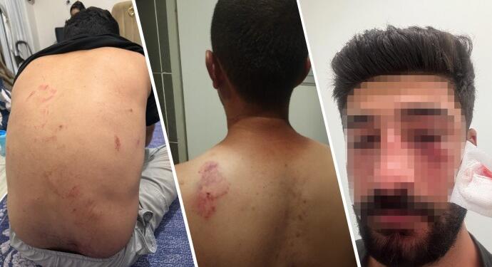 Kürtçe konuşan aileye saldıran 11 kişi serbest bırakıldı