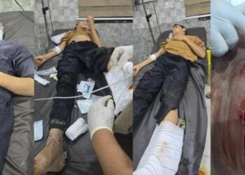 Dêrazor’da saldırı: 1’i çocuk 4 yaralı