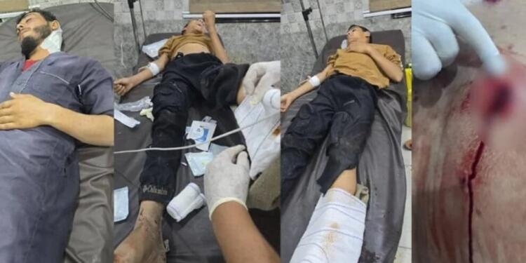 Dêrazor’da saldırı: 1’i çocuk 4 yaralı