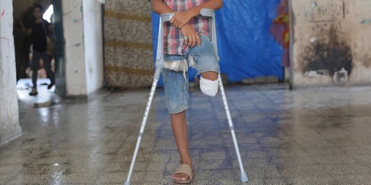 BM: 7 Ekim’den bu yana Gazze’de 4 bin çocuk ampute edildi