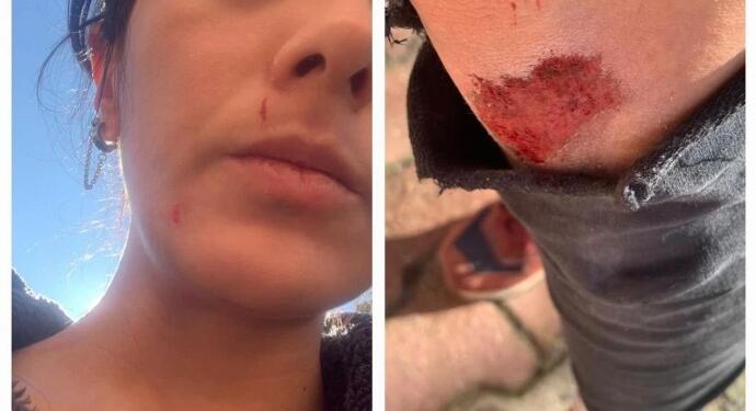 Gazeteci Ezgi Soysal’a saldırı: Yardım eden olmasaydı ölmüştüm