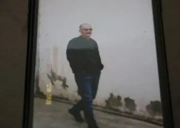 Hasta tutsak 50 kiloya düştü: Artık yutkunamıyor