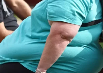 ABD’de yeni obezite ölçüsüne göre yetişkinlerin yüzde 70’i obez sayılabilir