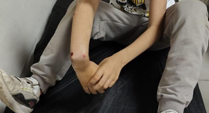 E.T.’nin kolunu kıran uzman çavuş hakkında iddianame