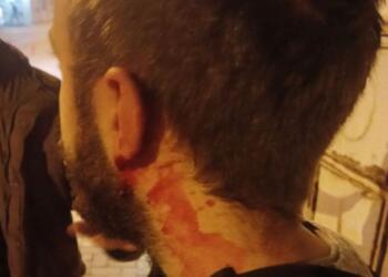 Bartın’da üniversite öğrencilerine saldırı