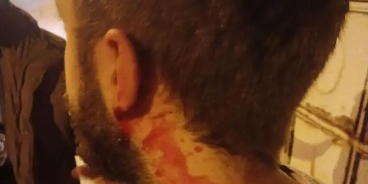 Bartın’da üniversite öğrencilerine saldırı