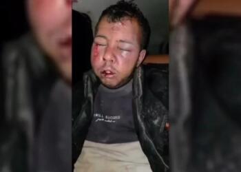 Türkiye sınırdan geçen gençlere saldırdı: 5 kişi yaralandı