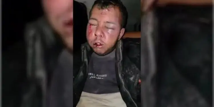 Türkiye sınırdan geçen gençlere saldırdı: 5 kişi yaralandı