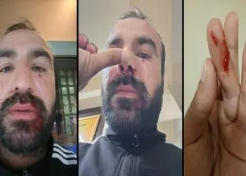 Şiddet uygulayan zabıtalar mağdur, şiddet gören yurttaş ise şüpheli oldu