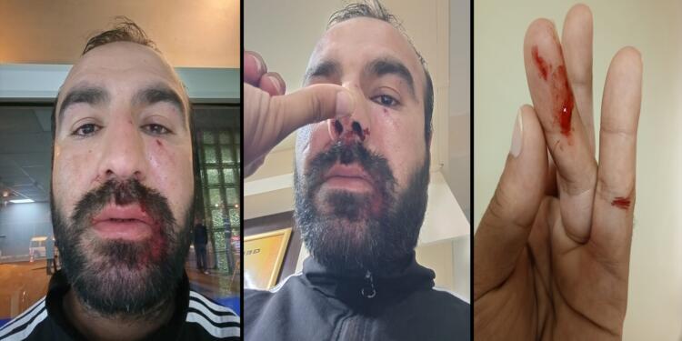 Şiddet uygulayan zabıtalar mağdur, şiddet gören yurttaş ise şüpheli oldu